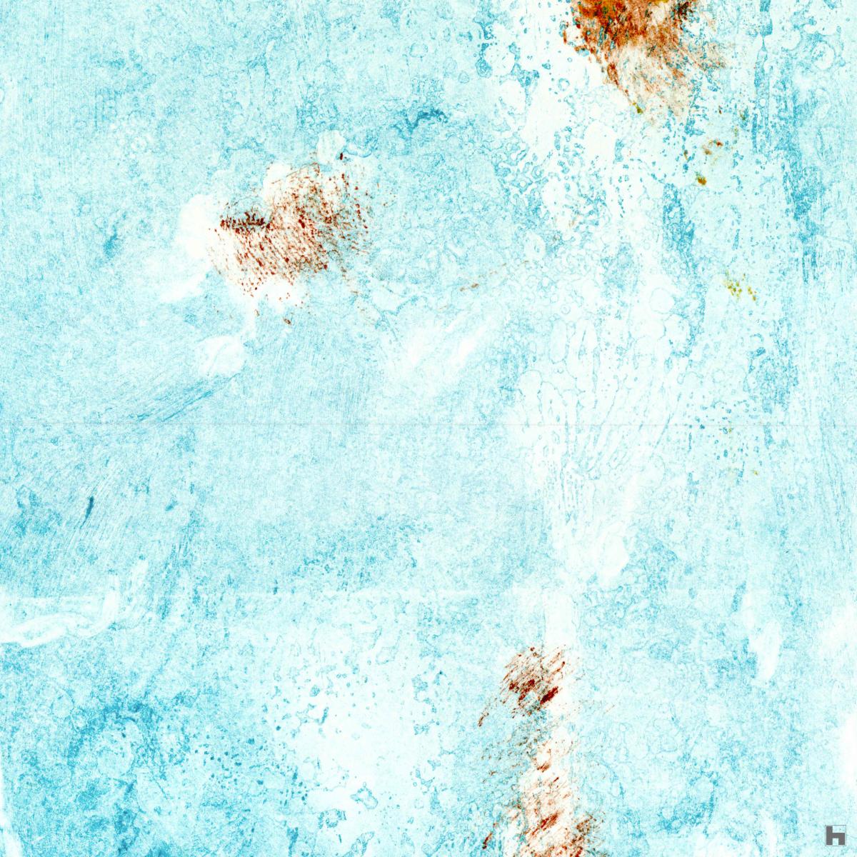 détail